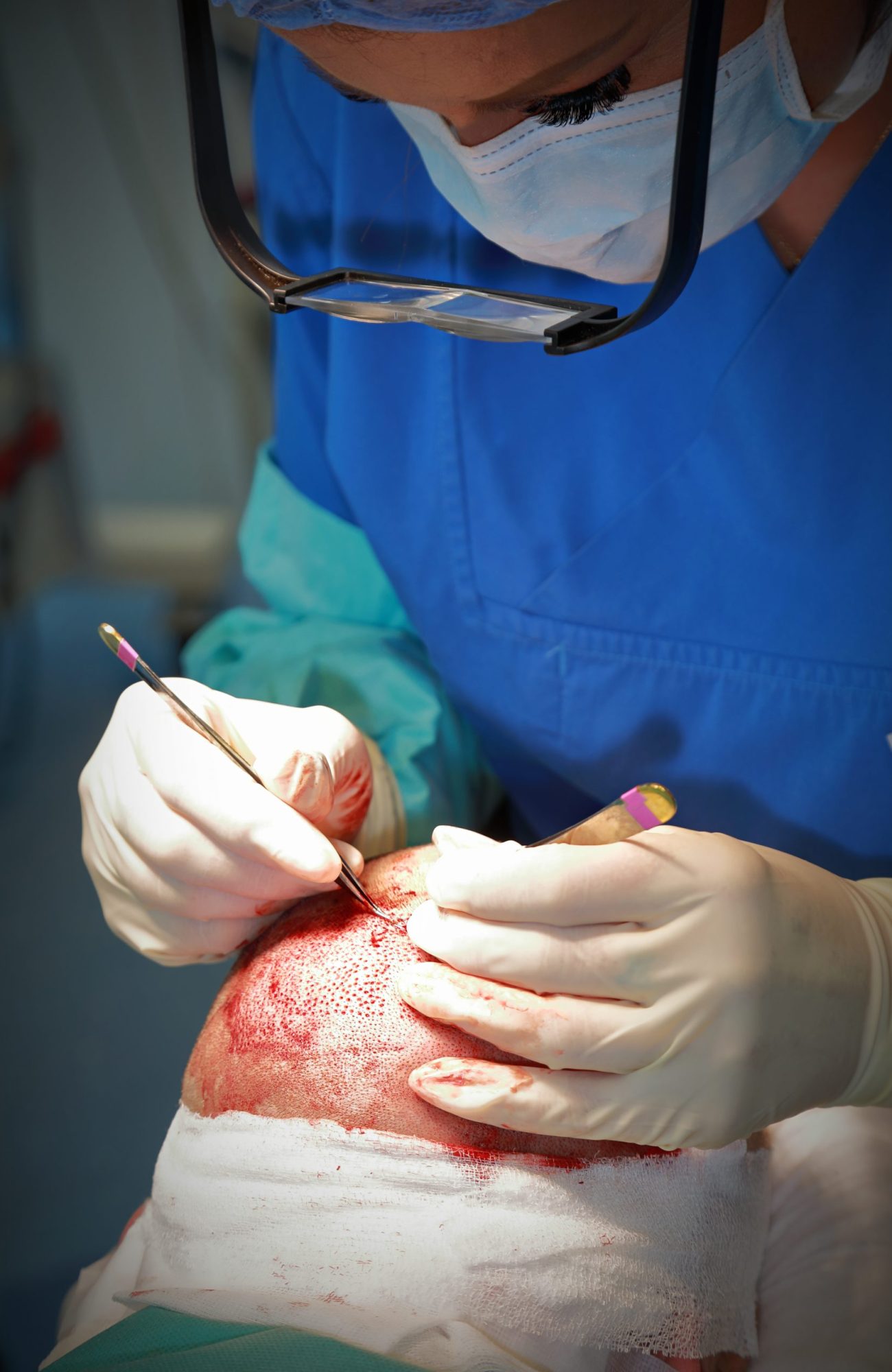 Munich-Hair-Transplantation-Dr.Rosenthal-Klinik2